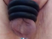 Without a penis and without testicles, empty sack ringed