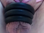 Without a penis and without testicles, empty sack ringed