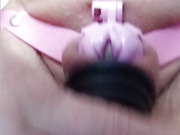 Without a penis and without testicles, empty sack ringed