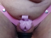 Without a penis and without testicles, empty sack ringed